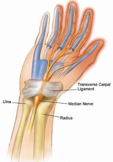 https://www.rainbowmassagephx.com/Specialize/Arms/CarpalTunnel.jpg